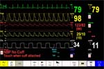 Air Ambulance Helicopter Patient Monitor